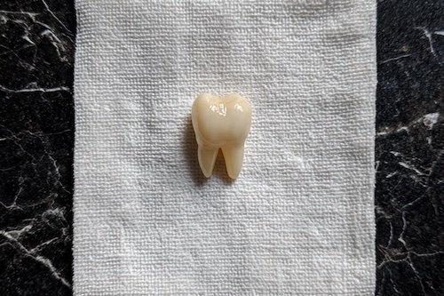 Real doctors can pull teeth!